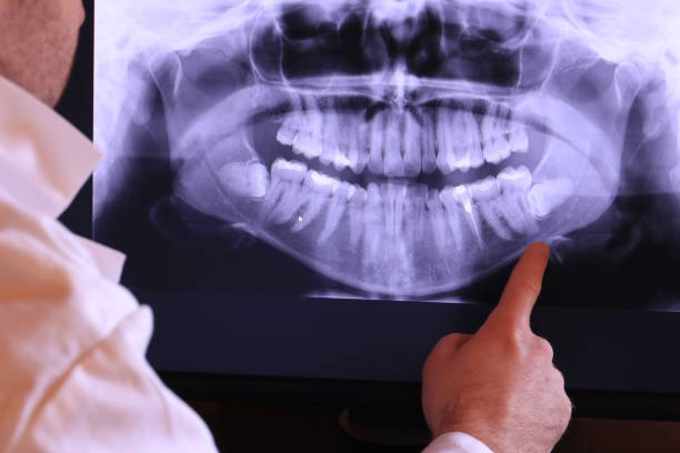 Best Broken Tooth Emergency  in Herricks, NY